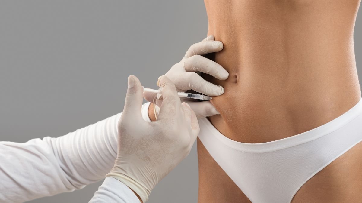 Cryolipolysis